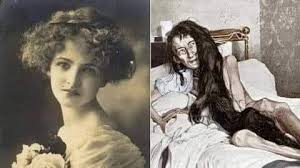 Don't look at these photos at night, trust us! Blanche Monnier A Lady Who Was Lockup In Room By Her Mother For 25yrs In 1901 Because She Too Beautiful