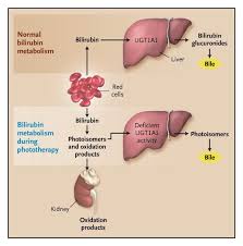 Image result for Phototherapy