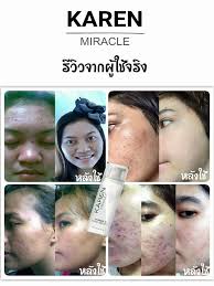 เพจหลัก แบรนด์ คาเรน มิราเคิล Karen Miracle