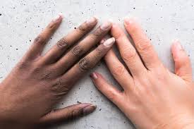 Apabila kulat berkembang mendalam, kuku mungkin berubah warna dan berubah bentuk. Punca Diagnosis Dan Rawatan Melanoma Subungual