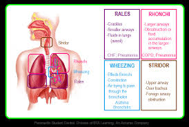 Paramedic Student Central Lung Sounds Reference Chart