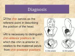 Image result for Shoulder Presentation