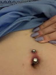 Is My Belly Button Piercing Rejecting Piercing