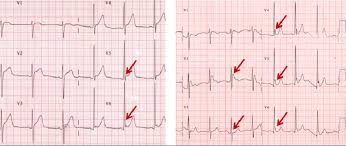 Image result for J Wave