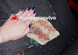 No Semaforo Academica De Medicina Leva Pedrada De Morador De Rua E Tem Cranio Afundado Rondoniaovivo Com