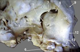 Image result for Maxillary Bone