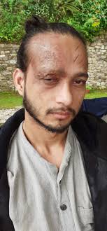 Frist_try #old_born_scar How is it ? Plz suggest how to do more realistic ?