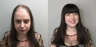 Female System Cal Vello Hair Solutions