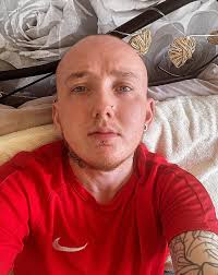 When does the bruising go away after getting your labret pierced?