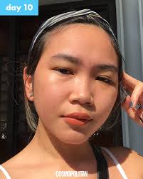 Myra E Moisturizer Review