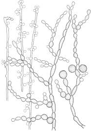 The genus fonsecaea contains two species: Fonsecaea Multimorphosa Sp Nov A New Species Of Chaetothyriales Isolated From A Feline Cerebral Abscess Sciencedirect