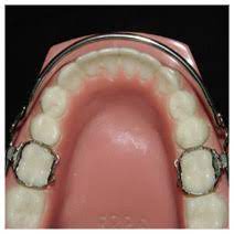 Jun 15, 2016 · crib bumpers are readily available and often included in crib bedding sets. Orthodontic Appliances Goldreich Orthodontics Plano Tx