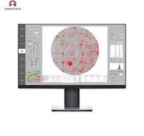 Cleanliness & Particle Analysis Software - ToronCPA™
