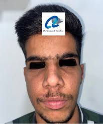 P.S. Dr. Abhinav K. Sachdeva (@p.s._dr.a.k.sachdeva) • Instagram photos and  videos