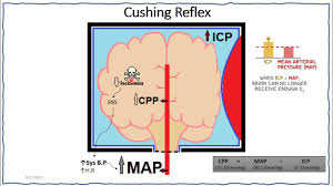Image result for Cushing Response