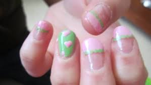 Read jane's story about one simple trick to end nail fungus within days, not months. Umirabgicb1ydm