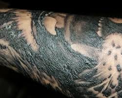 Die leute normalerweise gesetzt arbeit around das haus einfach weil sie benötigen ein schönes und bequemes haus. Gestern Neues Tattoo Stechen Lassen Am Unterarm Starke Verkrustung Und Heftiges Ziehen Bei Jeder Bewegung Nach Nur Einem Tag Ist Das Normal Korper Schmerzen Tattoopflege
