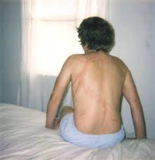 Sokndal bygdetun ble stifta i 1994.bygdetunet er ei forening som arbeider med sokndals historie knytta til personer, hendelser og gjenstander. Hva Ikke A Gjore I Tordenvaer Slik Unngar Du Lynnedslag I Tordenvaer