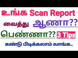 How To Predict Baby Gender By Using Scan Report In Tamil Pregnancy Tips Gender Prediction Youtube