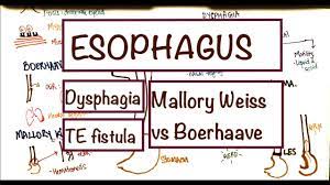 1 Minute Medicine How Does Crohn Disease Increase The Risk Of Calcium Oxalate Kidney Stones Usmle Youtube