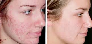 Bioestética Daisy Melo