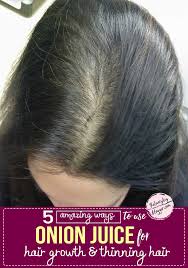 Onion Juice For Thinning Hair This Natural Remedy Might Not Smell Appealing But It Has Be In 2020 Onion Juice For Hair Hair Treatment Thinning Hair Growth Serum Diy