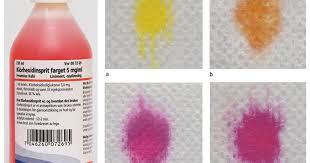 Image result for Cerebrospinal Fluid Color