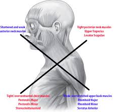 Mid Back Pain Central Ohio Spine And Jointcentral Ohio Spine And Joint