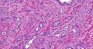 Hematoksilen Eozin Boyama Yontemi