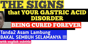 Asam lambung adalah sejenis cairan dalam sistem pencernaan yang terdapat dalam lambung dan terdiri dari asam klorida (hcl), kalium klorida (kcl), dan natrium klorida (nacl). The Signs That Your Gastric Acid Disorder Cured Forever Tanda2 Asam Lambung Bakal Sembuh Selamanya Youtube