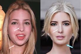 Has Trump ever had major surgery?