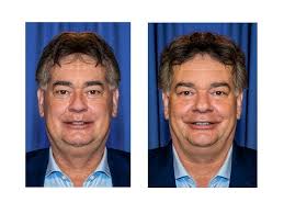 23.12.2021 · vizekanzler werner kogler (grüne) verweist im zusammenhang mit den nun doch strengeren regeln zu silvester auf eine klare empfehlung der … Werner Kogler Fluch Der Europas Webseite