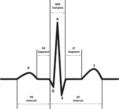 He has been drinking heavily with friends. A 12 Lead Electrocardiogram Database For Arrhythmia Research Covering More Than 10 000 Patients Scientific Data