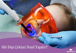 Süt Dişi Çekimi Nasıl Yapılır? - Perspektif Ağız ve Diş Sağlığı Polikliniği