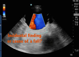 Image result for Incidental Imaging Finding