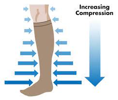 Pin On Varicose Veins Remedies