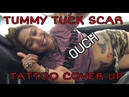 Tummy tuck scars are inevitable in every abdominoplasty procedure. My Tummy Tuck Scar Tattoo Cover Int Tattoo Jakarta Youtube