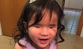 Heart-melting video shows blind girl terrified of hospitals SINGING during  brain scan to keep calm