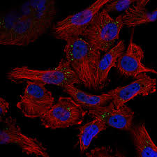 Abdul wahab 10/13/2015 07:49:00 pm. Cell Atlas Pigp The Human Protein Atlas