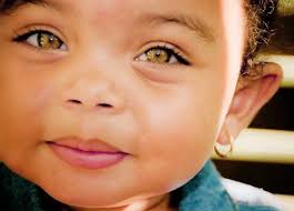 Can people have golden eyes?