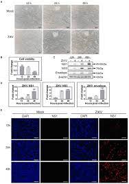 The cashier is the set of all cash transactions. Frontiers Zika Virus Infection Disrupts Astrocytic Proteins Involved In Synapse Control And Axon Guidance Microbiology