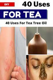 Tea Tree Oil Is More Useful Than You Think Here Are 40 Reasons You Need It At Home Diy Life Hacks Hacks Diy Diy Life