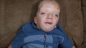 Special Books By Special Kids Grayson S Story A Medical Condition So Rare It S Named After Him Facebook