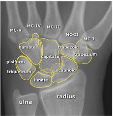 Maybe you would like to learn more about one of these? X Wrist Startradiology