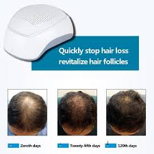 There is a multitude of reasons that promote the use of this therapy. Laser Therapy Hair Growth Helmet Regrowth Device Anti Hair Loss Treatment Anti Hair Loss Promote Hair Regrowth Cap Massage Buy At The Price Of 124 23 In Aliexpress Com Imall Com