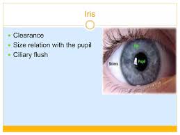 Image result for Ciliary Flush
