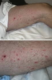 Under many circumstances, a gunshot wound to the and or foot, or even one that grazes the abdomen or face aren't likely to be fatal. Forensic Emergency Medicine Clinical Gate