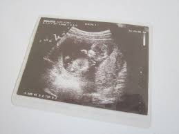 How To Preserve Your Adorable Ultrasound Pictures Ultrasound Pictures Baby Ultrasound Baby Ultrasound Pictures
