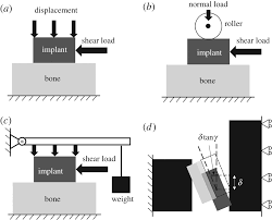 We did not find results for: Biomechanical Behaviours Of The Bone Implant Interface A Review Journal Of The Royal Society Interface