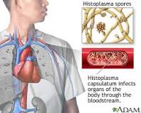 Image result